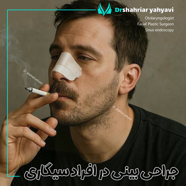جراحی بینی در افراد سیگاری + دکتر شهریار یحیوی