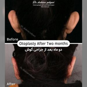 جراحی گوش در تهران- دکتر یحیوی