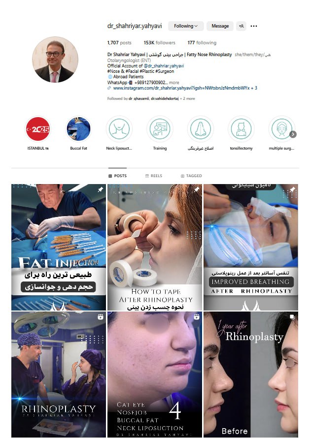 اینستاگرام جراح بینی خوب در تهران - دکتر شهریار یحیوی