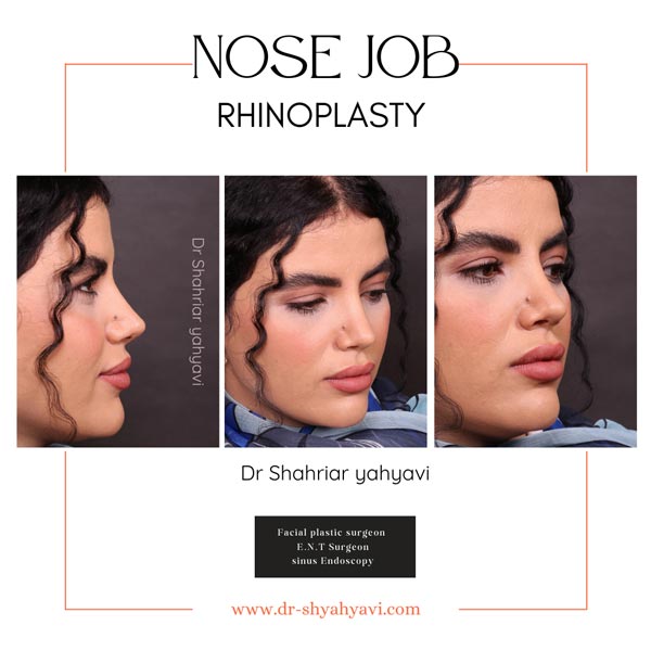 جراح الأنف في طهران