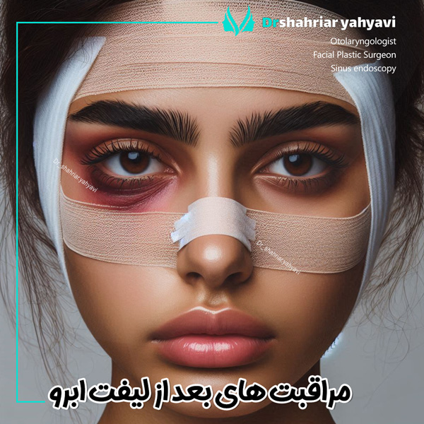 مراقبت های بعد از جراحی لیفت ابرو - دکتر یحیوی