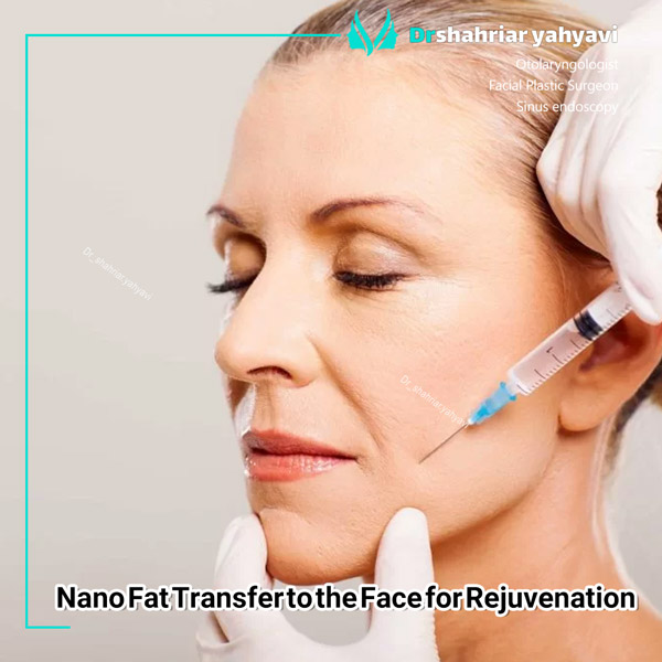 Nano Fat Transfer to the Face for Rejuvenation