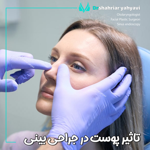 تاثیر پوست در جراحی بینی + دکتر شهریار یحیوی
