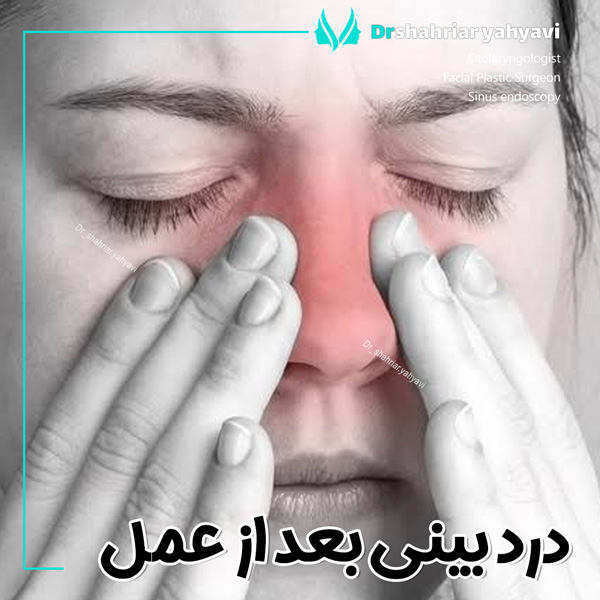 درد بینی بعد از عمل + دکتر شهریار یحیوی