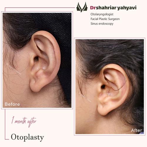 جراحی-گوش-19