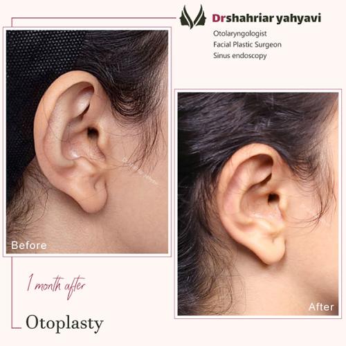 جراحی-گوش-20
