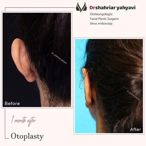 جراحی-گوش-21
