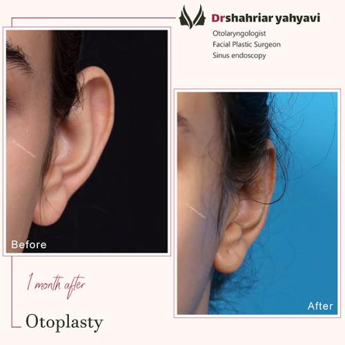 جراحی-گوش-24