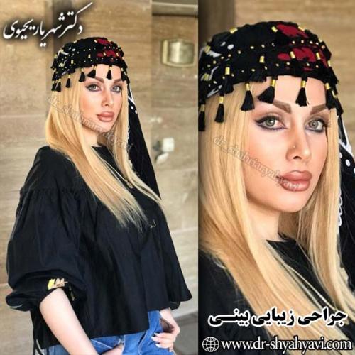 جراحی-بینی-101