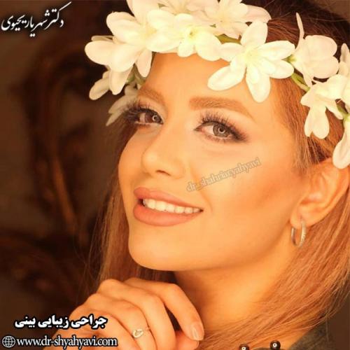 جراحی-بینی-108