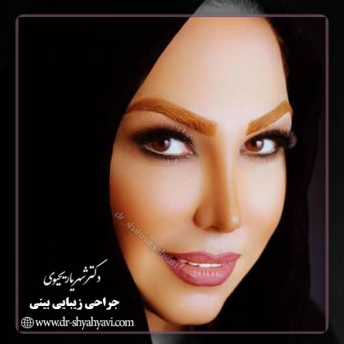 جراحی-بینی-116