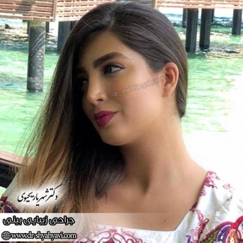 جراحی-بینی-156