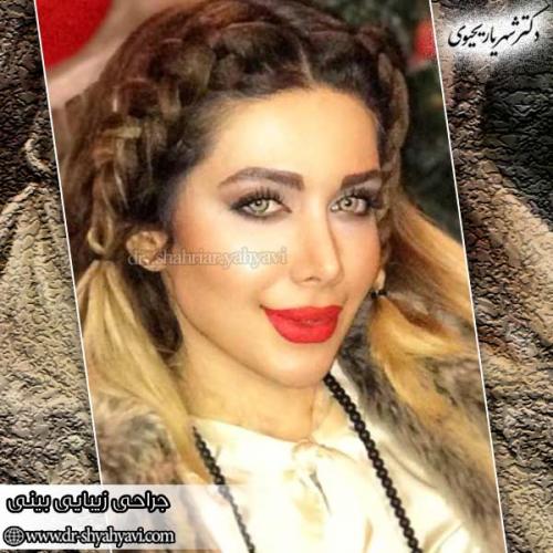 جراحی-بینی-167