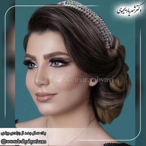 جراحی-بینی-171