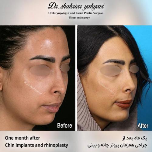 جراحی-بینی-570