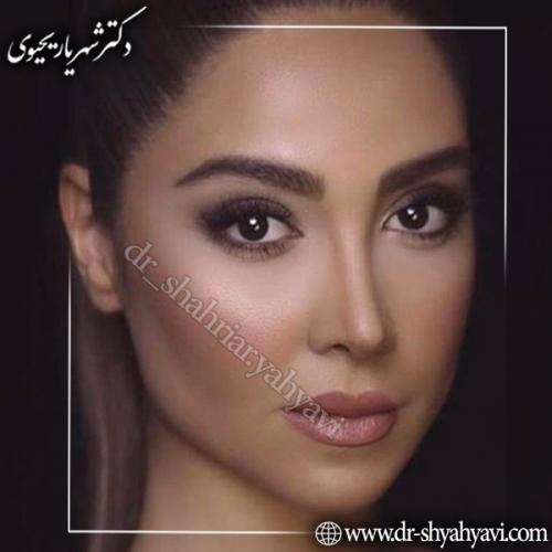 جراحی-بینی-62