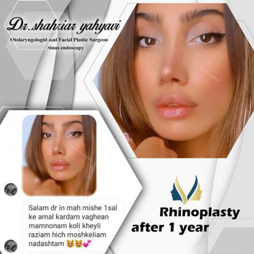 جراحی-بینی-632 (1)