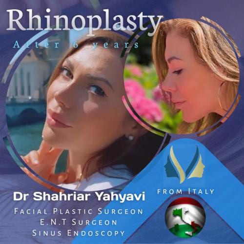 جراحی-بینی-634 (1)