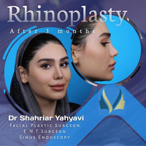 جراحی-بینی-635 (1)