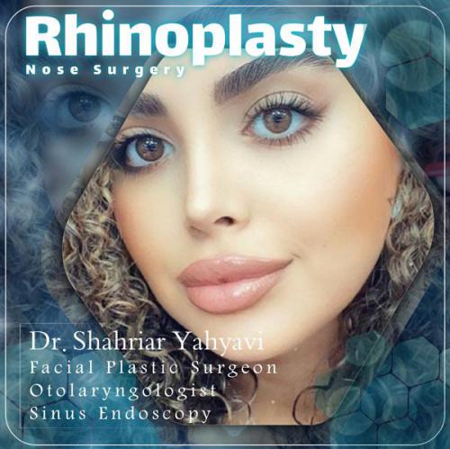 جراحی-بینی-636 (1)