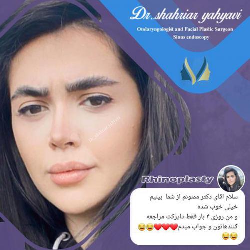 جراحی-بینی-643