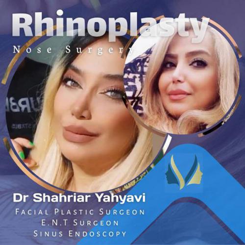 جراحی-بینی-647