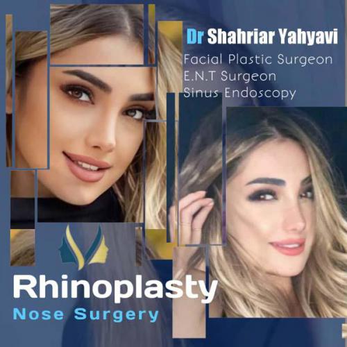 جراحی-بینی-648