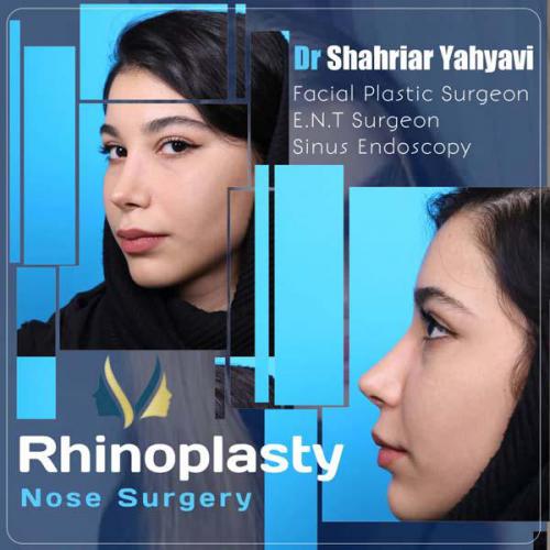 جراحی-بینی-649