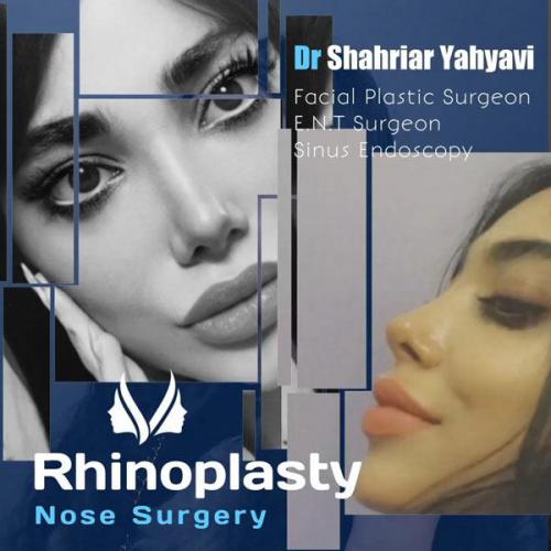 جراحی-بینی-650