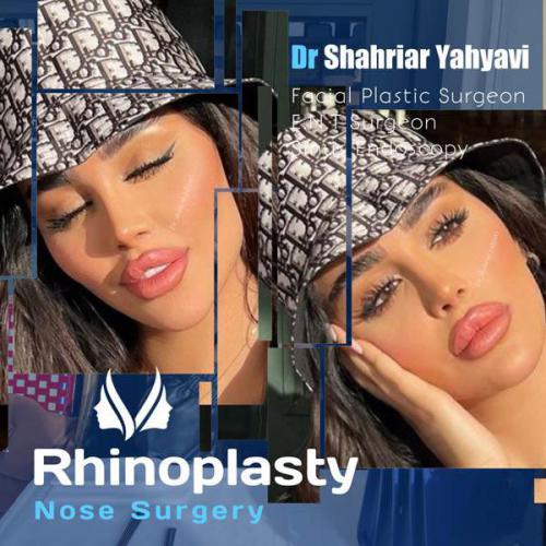 جراحی-بینی-651