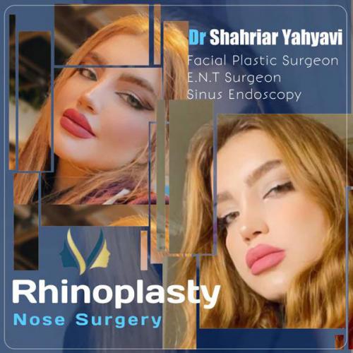 جراحی-بینی-653