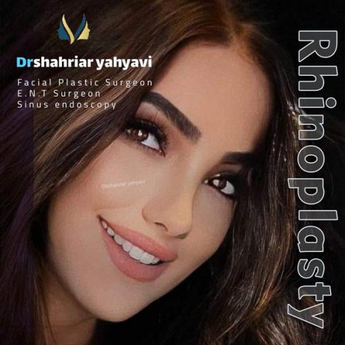 جراحی-بینی-657