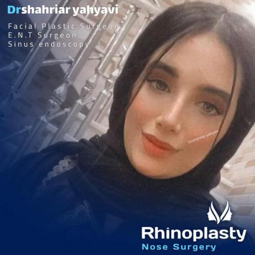 جراحی-بینی-659