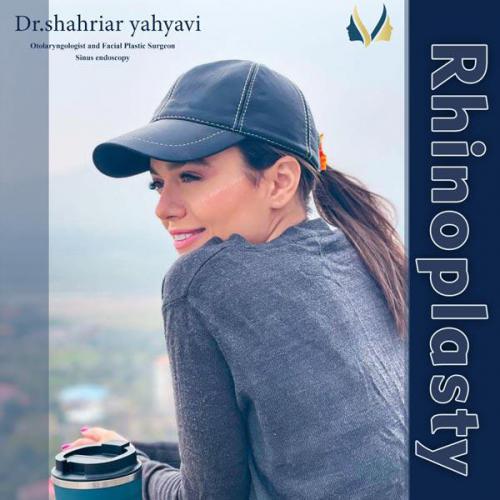 جراحی-بینی-662