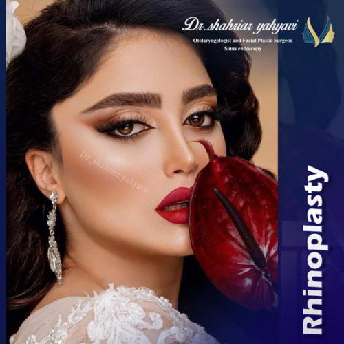 جراحی-بینی-663