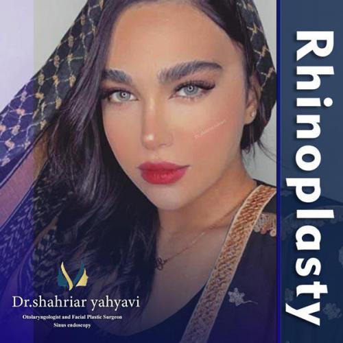 جراحی-بینی-664