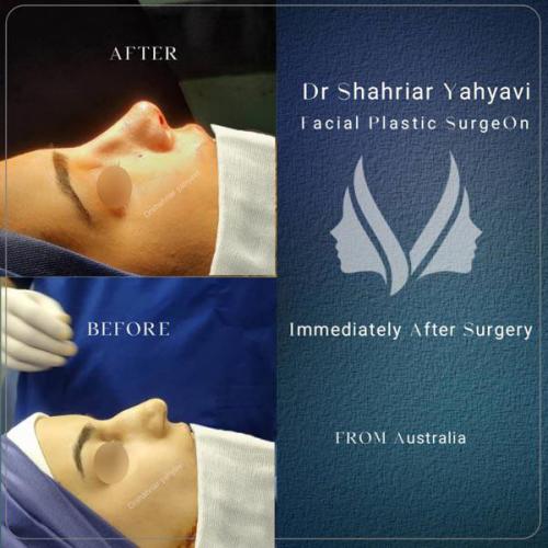 جراحی-بینی-667