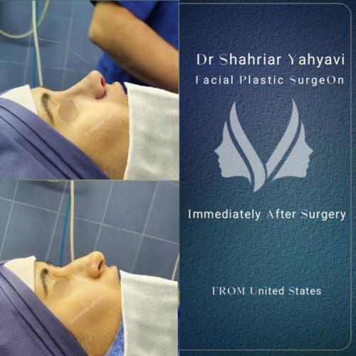 جراحی-بینی-668