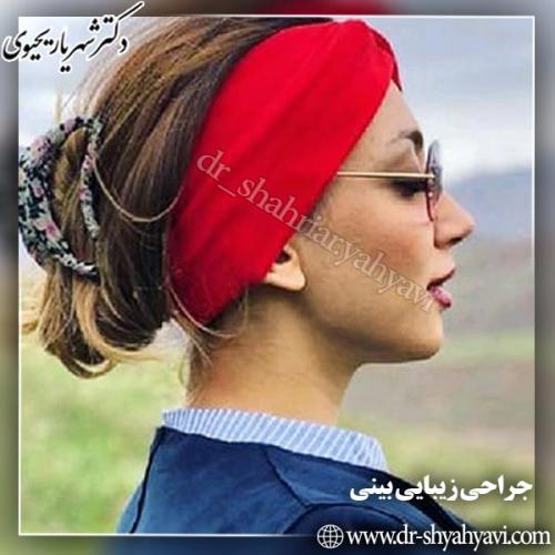 جراحی-بینی-67