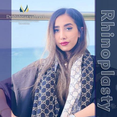 جراحی-بینی-673