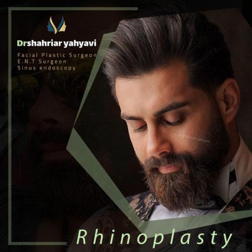 جراحی-بینی-686