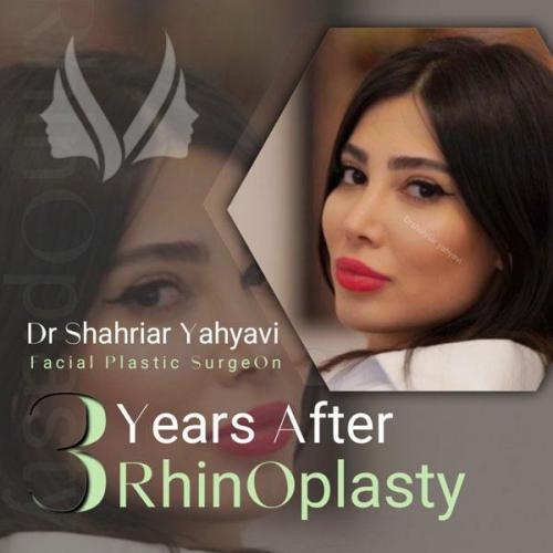 جراحی-بینی-687