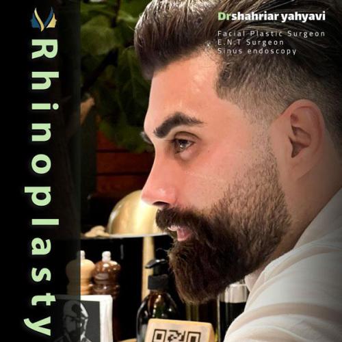 جراحی-بینی-688