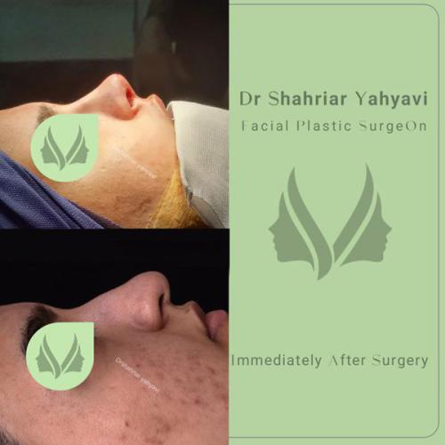 جراحی-بینی-690