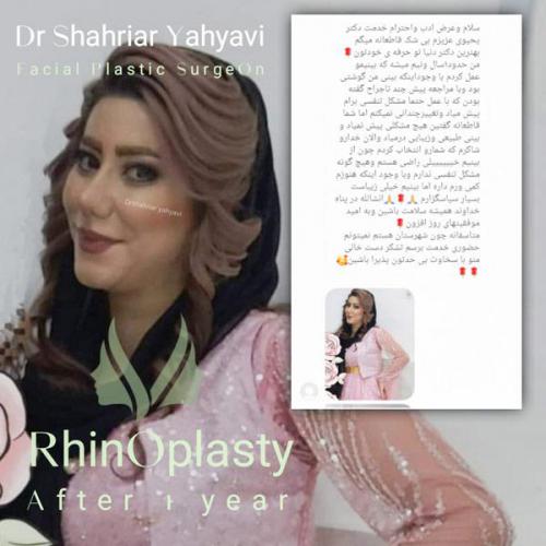 جراحی-بینی-698