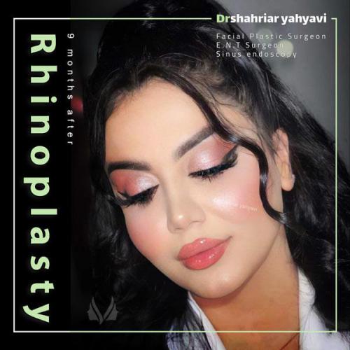 جراحی-بینی-707