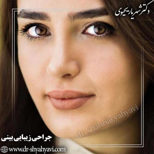 جراحی-بینی-75