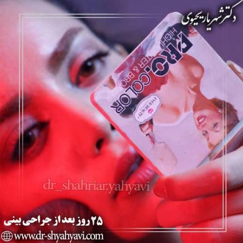 جراحی-بینی-79