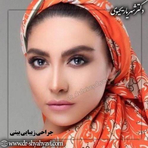 جراحی-بینی-95