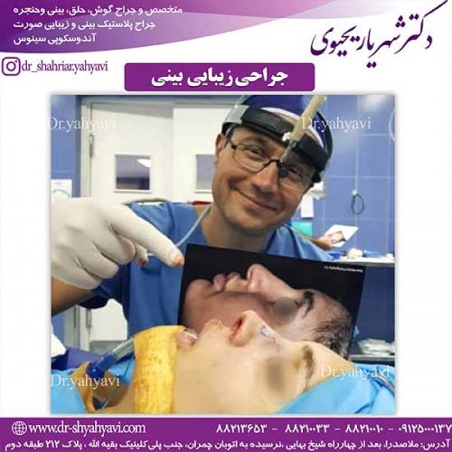 جراحی-زیبایی-بینی-21